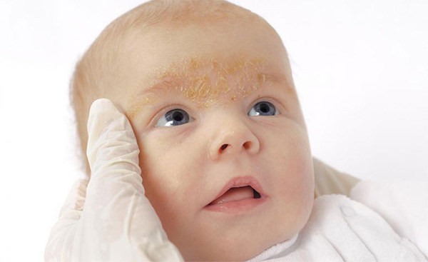 Có nên dùng kem dưỡng ẩm cho trẻ sơ sinh hay không ?